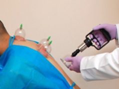 4. Llojet e Hixhames