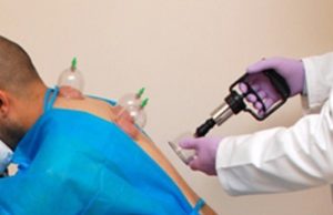 4. Llojet e Hixhames