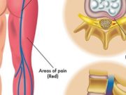 Rukje për shiatikun