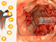 Për shkak të kësaj pije ka një rrezik të madh që ju të merrni sëmundje të tmerrshme…