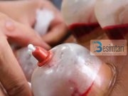 Koha më e mirë për hixhame