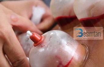 Koha më e mirë për hixhame