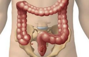 Si të trajtoni parazitët e zorrëve me dy metoda natyrale