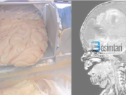 Prindër, bëni kujdes! Mos ua jepni këtë ushqim fëmijëve – shkakton kancer