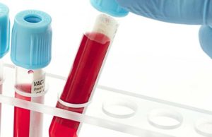 Studim: 10 faktet shokuese rreth homoseksualizmit dhe LGBTI-së !