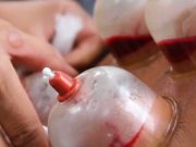 Shërimi është në tri gjëra