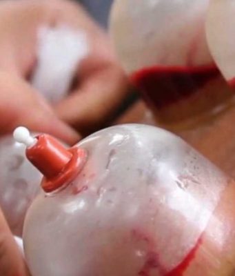 Shërimi është në tri gjëra