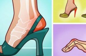 Le te mos kërcasin me këmbet e tyre