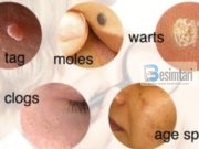 Nishanet, Lythat, Taget