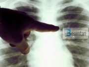 Ja kush është shkaku kryesor i kancerit! Mësojeni, ose vdisni!