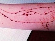 LOJA “BALENA E KALTËR” APO “BLUE WHALE GAME” E NJOHUR NDRYSHE EDHE SI LOJË VETËVRASËSE PËR TË RINJTË!