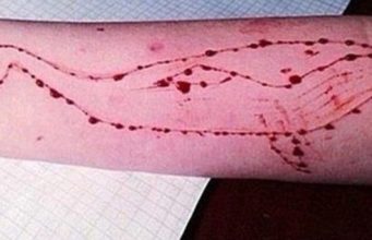 Rreziku nga balena blu, çfarë është dhe si të mbroni fëmijët