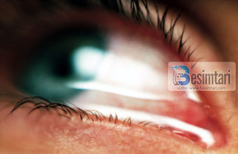 Mos qaj nëse mundesh!? Porositë e fundit nga i Dërguari i fundit s.a.v.s.