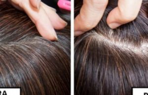 3 maska natyrale që ju ndihmojnë kundër thinjave