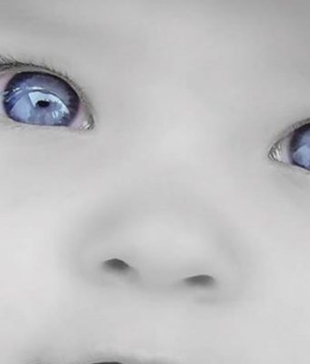 Mos shko tek falltorët,dervisht apo disa plaka që “fryn” për shërimin e mësyshit ndaj fëmijës? Ti mund ta bësh vet !