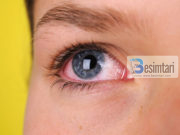 8 shenjat që tregojnë problemet me shëndetin përmes syve tuaj