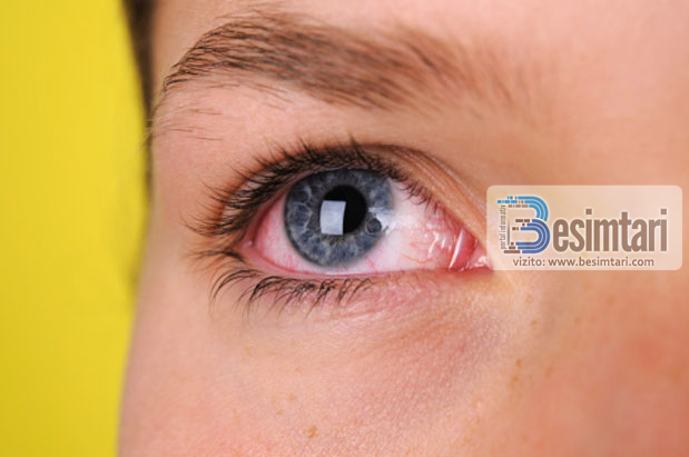 8 shenjat që tregojnë problemet me shëndetin përmes syve tuaj