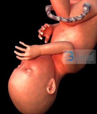 Varrosja gjallë e fëmijës femër