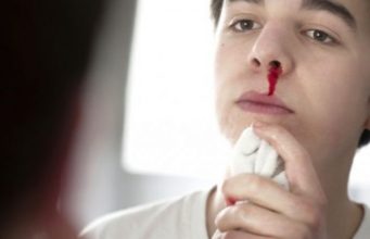 Rukje për gjakrrjedhjen nga hundët