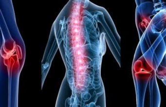 Si të trajtoni dhimbjet e kockave