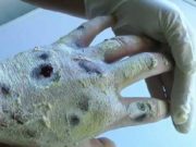 Crockadeal – eshte droga me tmerruese ne bote qe qarkullon