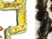 Përzierja që do të heq menjëherë nga trupi juaj disa kilogramë toksina!