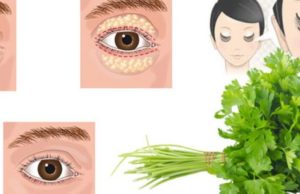 Maska me bazë majdanozin që zhduk qeskat e errëta nën sy për 1 ditë