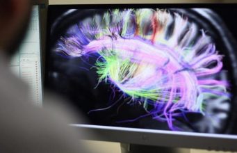 Hulumtim, truri i psikopatëve punon më ndryshe