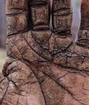 VARFËRIA e vërtetë, ndodhet në zemrën e shkretë