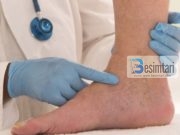 11 frutat dhe perimet kundër këmbëve të ënjtura