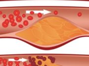 Kjo pije natyrale sheron infeksionet urinare