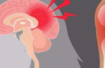 80% e shqiptarëve janë të lodhur, të sëmurë dhe të dobët, sepse nuk marrin mjaftueshëm këtë mineral