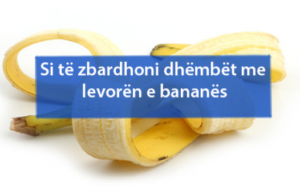 Si të zbardhoni dhëmbët me levorën e bananës –