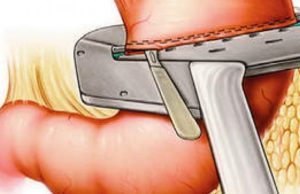 KUR NUK DO TË KEMI NEVOJË PËR ILAÇE?!