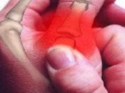 Luftoni reumatizmin me këtë përbërës