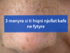 3 menyra si ti hiqni njollat kafe ne fytyre