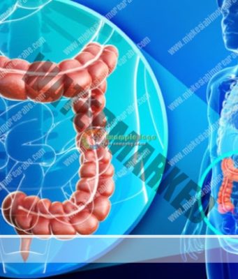 8 Ushqimet më të mira për zorrët