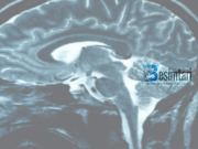 8 Shkaqet që sjellin dhimbjen e kokës