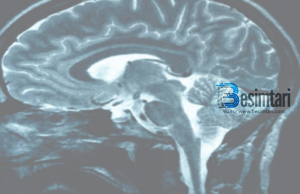 8 Shkaqet që sjellin dhimbjen e kokës