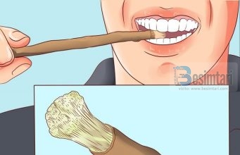 Kur preferohet përdorimi i misvakut (furçës për të pastruar dhëmbët)