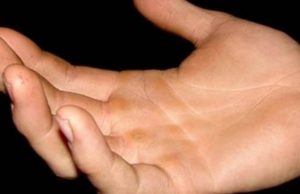 Sot, miku im më i mirë më qëlloi në fytyrë – Interesante