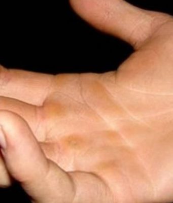 Sot, miku im më i mirë më qëlloi në fytyrë – Interesante