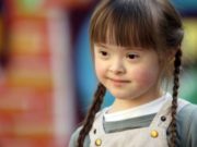 Çka është Down sindrom-i?