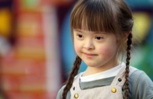 Çka është Down sindrom-i?