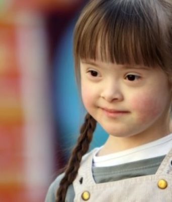 Çka është Down sindrom-i?