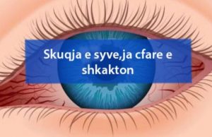Skuqja e syve,ja cfare e shkakton