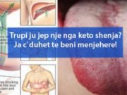 Trupi ju jep nje nga keto shenja? Ja c`duhet te beni menjehere!