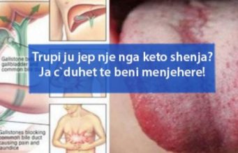 Trupi ju jep nje nga keto shenja? Ja c`duhet te beni menjehere!