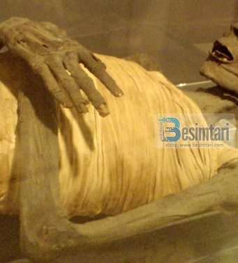 A e keni ditur? Ky trup u zbulua në vitin 1898