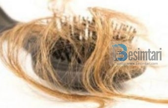 E pabesuseshme: Nëse flokët tuaj bien më shumë se normalisht ju duhet të lexoni këtë!